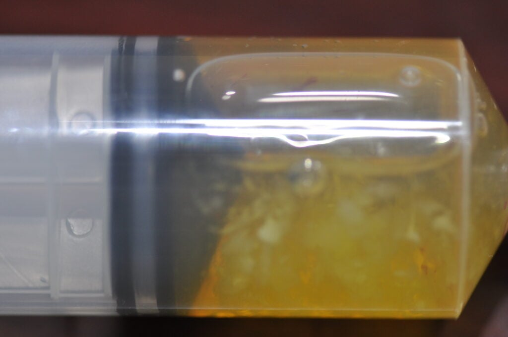 Synovial fluid | ARA Synovial fluid | ARA