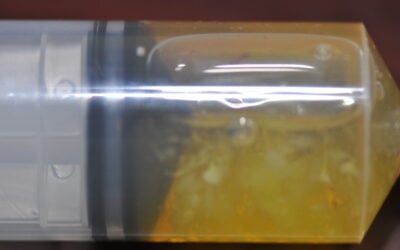 Synovial fluid